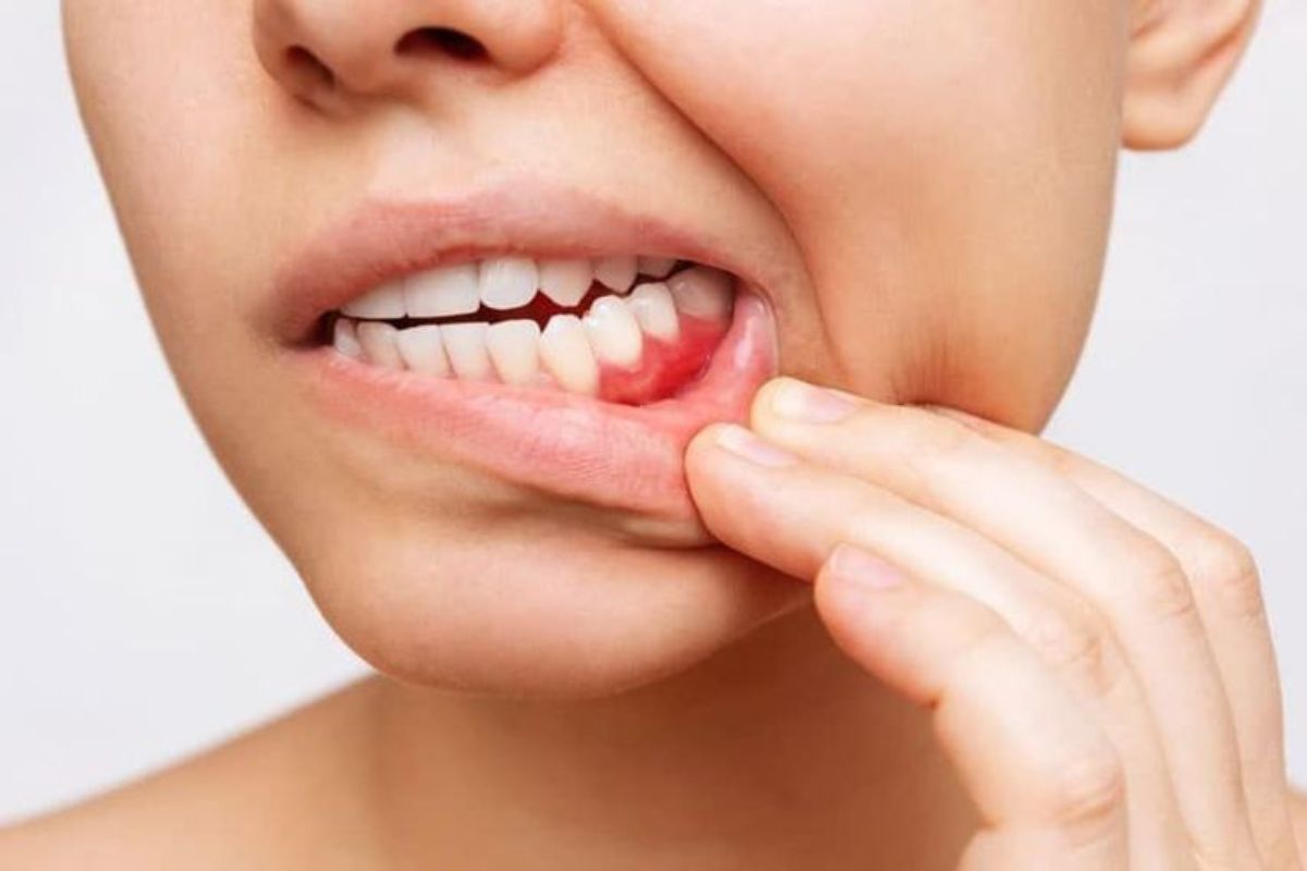 Periodontal Disease Is Linked To Systemic Diseases