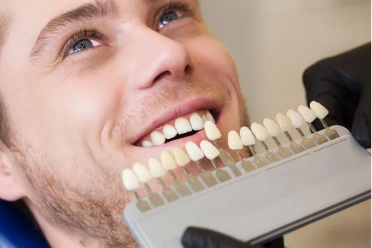 Dental Veneers 7 Fast Fixes