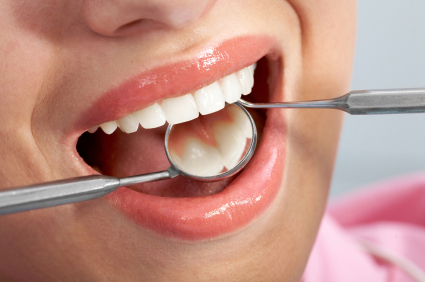 Dental professional examining patient's teeth with mirror and explorer tool during checkup.