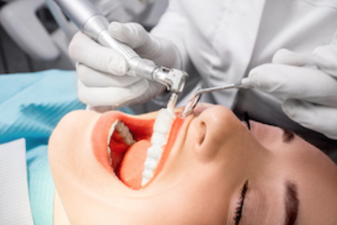 Dental professional performing oral procedure on patient's open mouth in clinical setting.