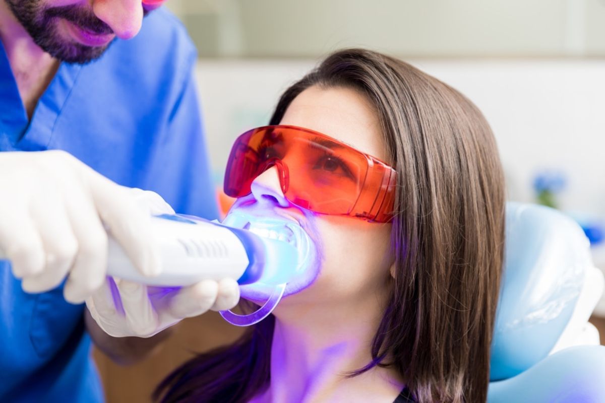 Best Teeth Whitening Options
