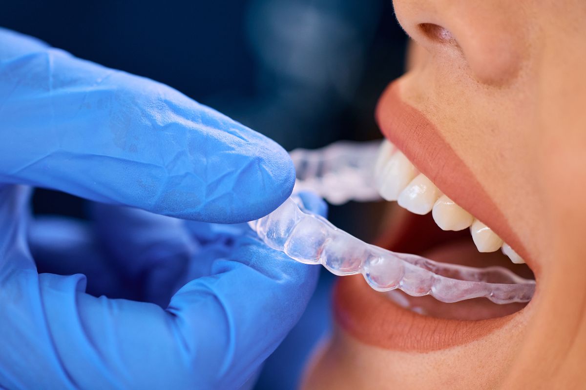Does Invisalign Treatment Really Work