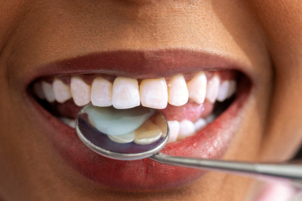 Why Regular Gum Cleanings Matter