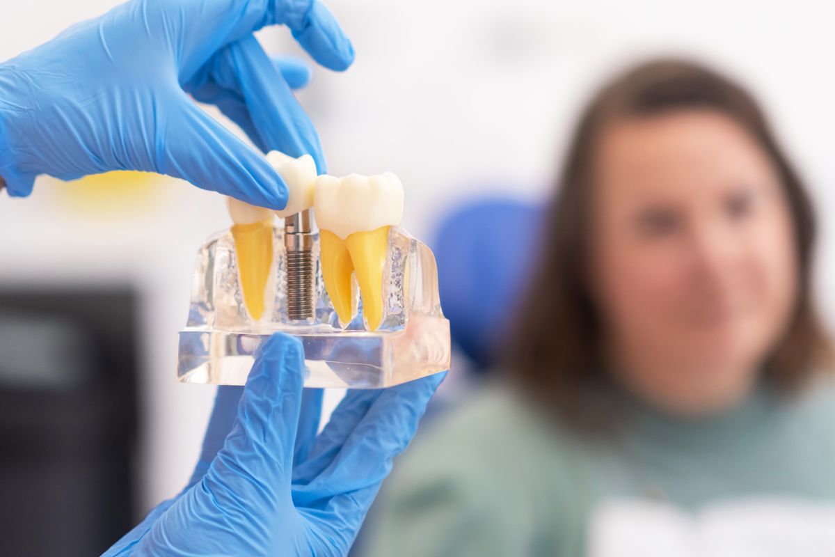 Patients Wish They Knew Before Getting Dental Implants