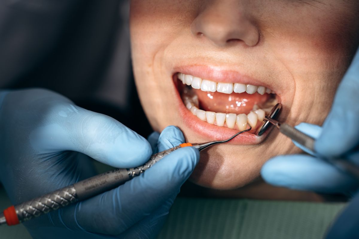 Why Regular Dental Checkups Matter