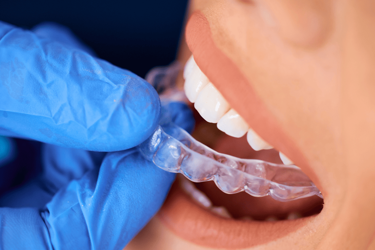 Invisalign Treatment in Raleigh
