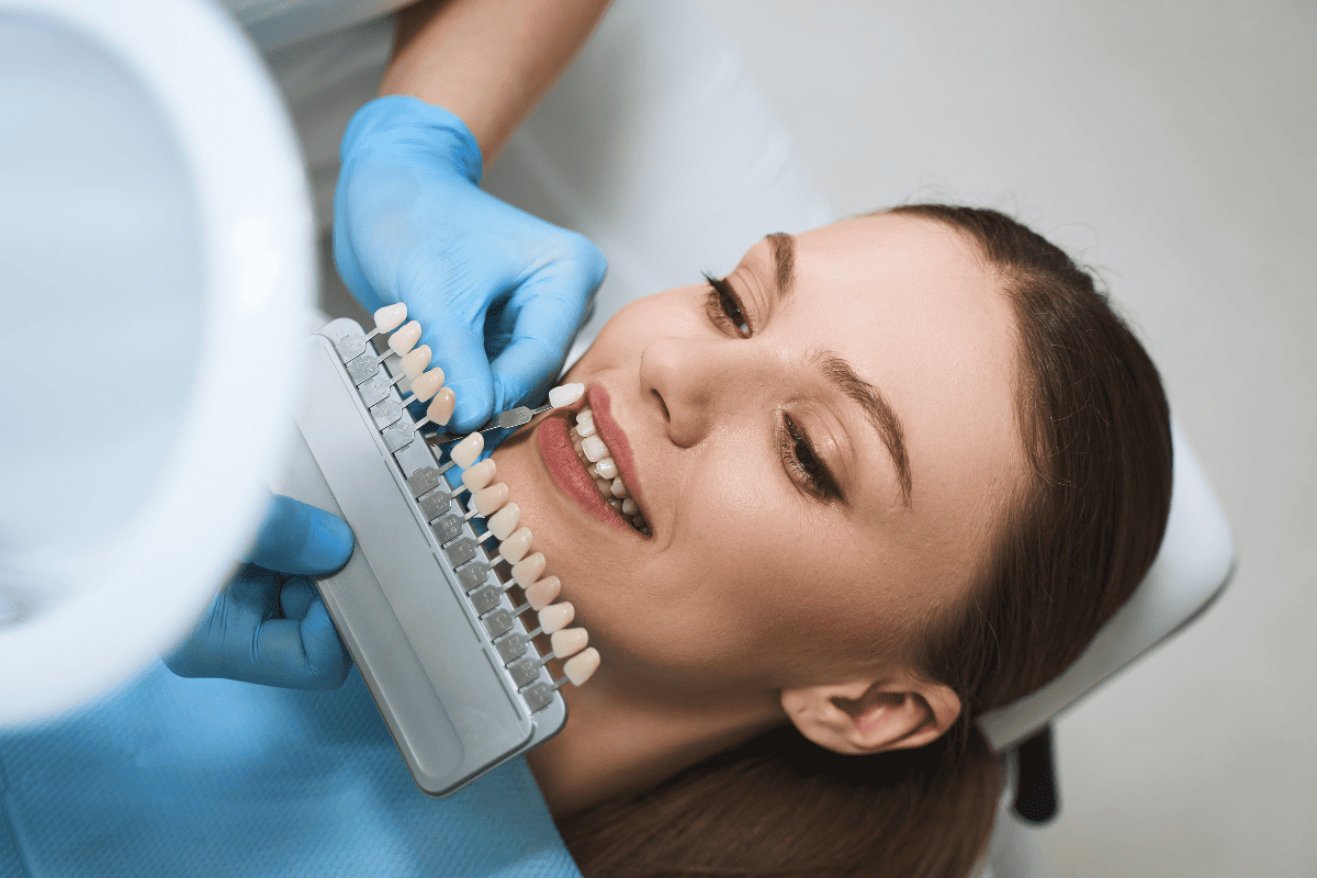 Dentist holding veneers near a patient's mouth